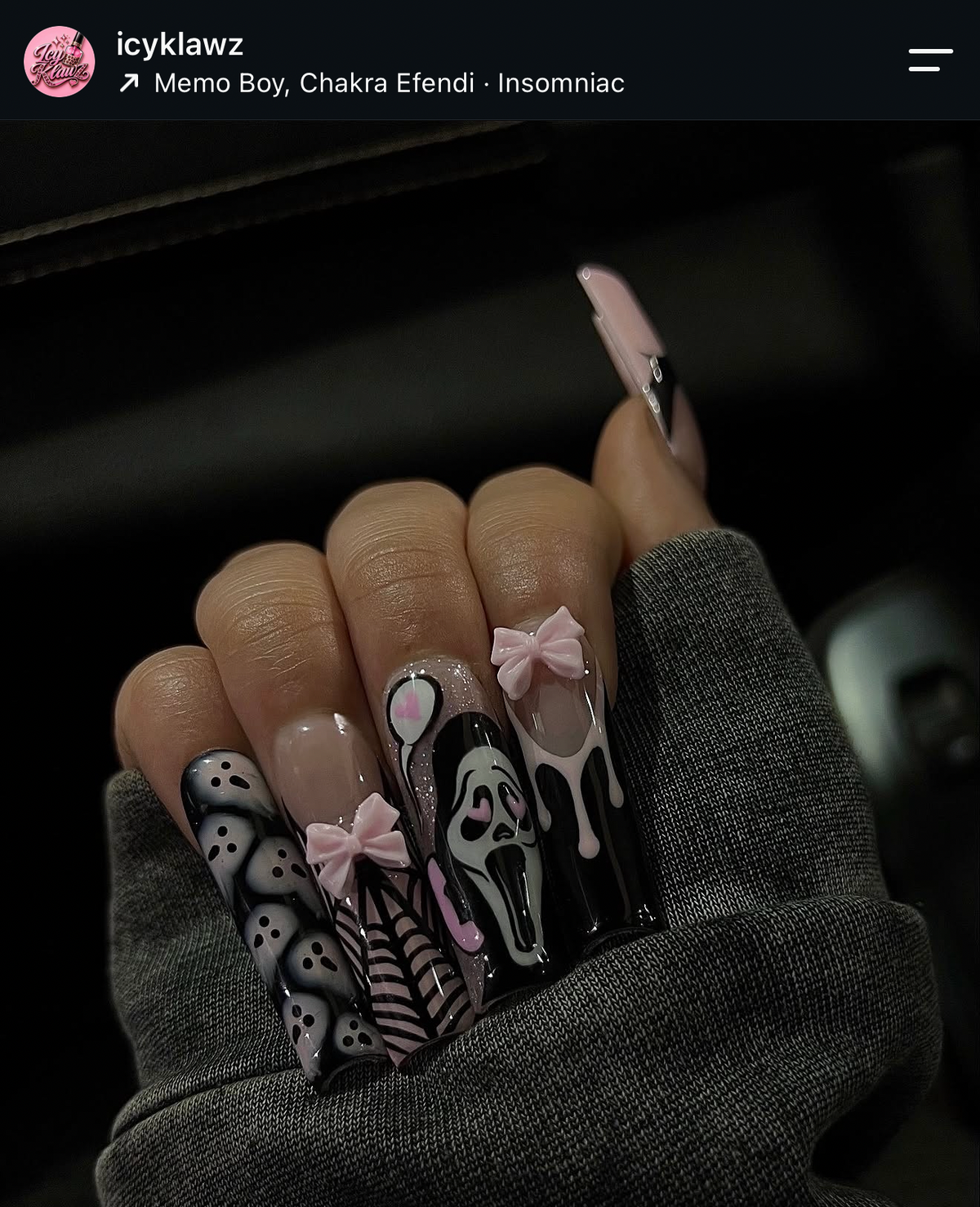 SET 31
