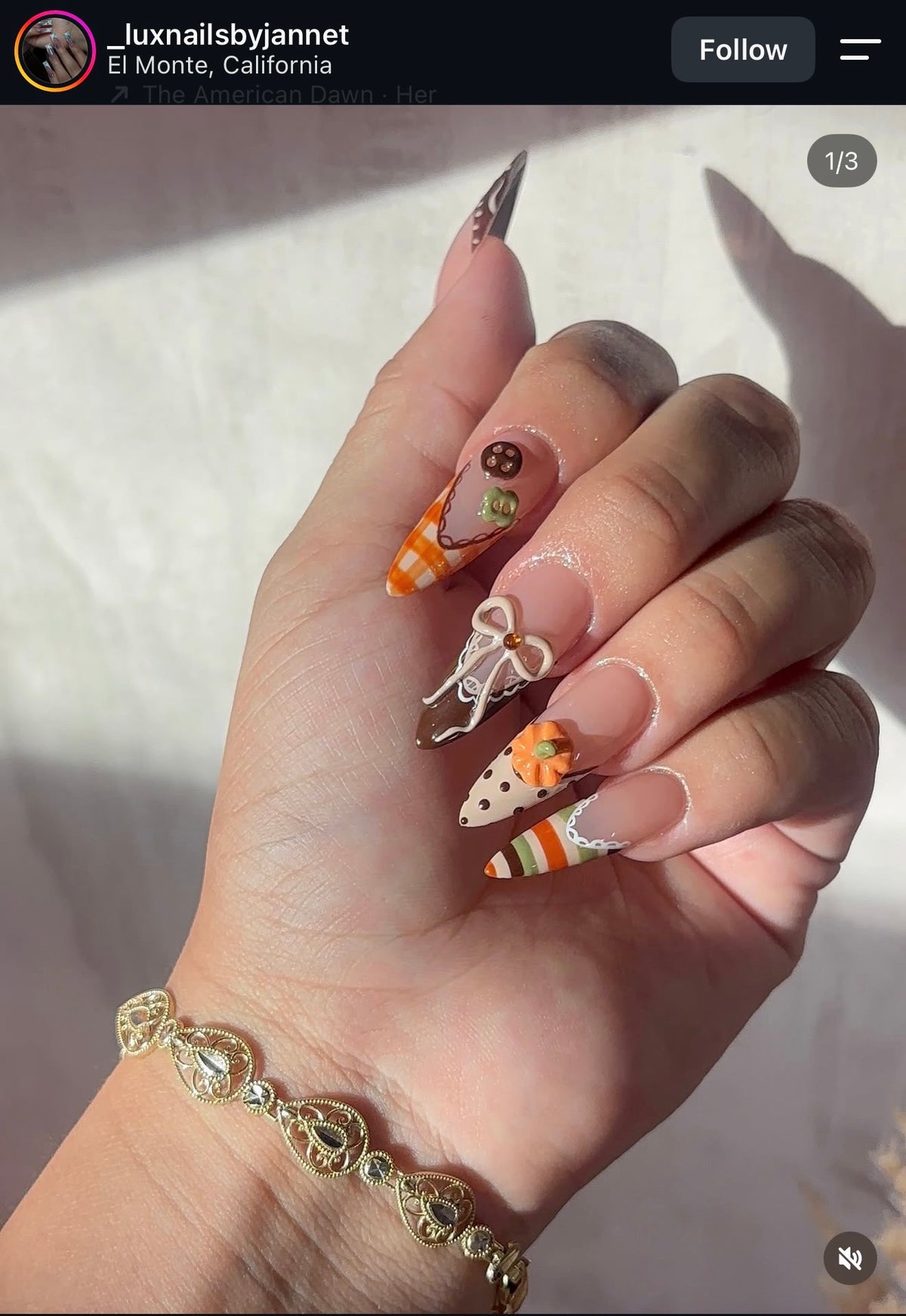SET 20